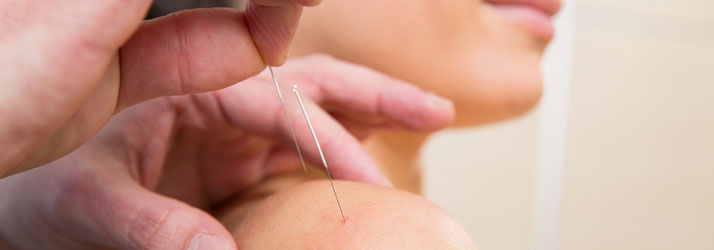 Chiropractic Oakland NJ How Acupuncture Works
